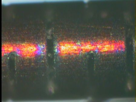 Ống thông tim sản xuất bằng laser.